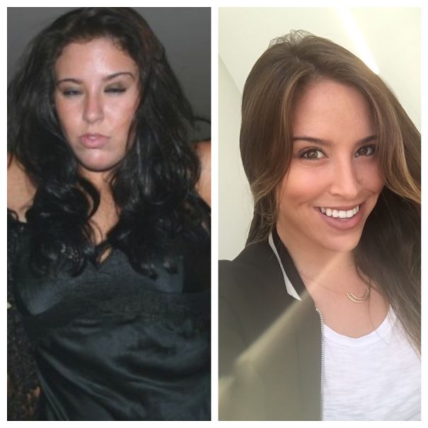 Study Reveals Alarming Before-And-After Pics Showing Happens When You